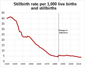 Stillbirth rate in England and Wales