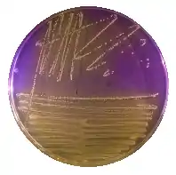Orange bacterial growth on purple agar plate