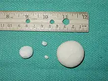 Dog struvite bladder stones