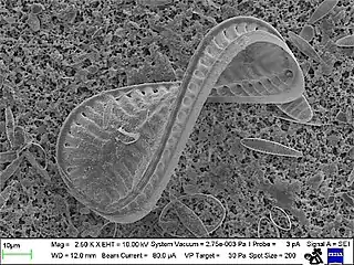 Diatom Surirella spiralis