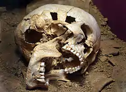 Severed head of a young woman, middle Bronze Age