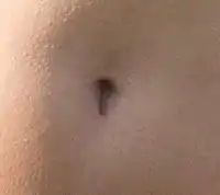 A t-shaped navel