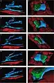 Figure 22. Rat jejunum. A-E. 3-D image reconstruction from 5 serial sections of telocytes (blue) in lamina propria: telopodes branching in a 3-D pattern. Telocyte’s nucleus is colored in violet. F-J. Computer-aided volume rendering and different-angle stereoscopic views of a telocyte (blue) surrounding a nerve fiber (green) in muscularis mucosa (dark red).