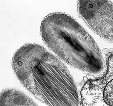 Transmission electron micrograph of stage II epixenosomes.