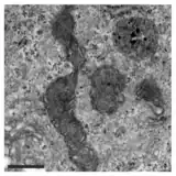 TEM image of mitochondria after PXA treatment. The matrix morphology has been severely distorted and cristae can no longer be recognised.