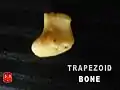 Trapezoid bone.