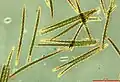 Trichoglossum hirsutum spores 400x phase contrast