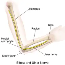 Cubital tunnel syndrom causes pain in ulnar nerve.