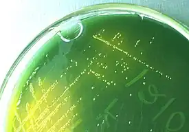 Yellow colored (sucrose-fermenting) colonies of Vibrio cholerae on TCBS agar.