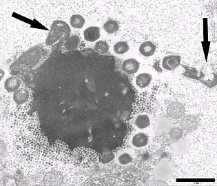 Electron micrograph of a virus factory in an amoeba co-infected with Mimivirus-dependent virus Zamilon (small particles) and Mont1. Arrows show abnormal Mont1 particles (scale bar: 0.1 μm)