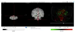 Expression locations of Fam188a in the human brain