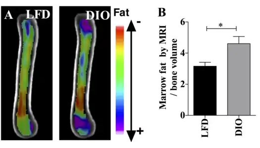 This figure demonstrates the use of MRI imaging (9.4T scanner) along with advanced image processing to quantify BMAT.  The images and graph demonstrate that BMAT is higher in obese compared with lean mice. B6 mice were fed HFD from age 4 wk until age 16 wk. BMAT was quantified by MRI. A) n=10 superimposed group average images are shown B) BMAT normalized to bone volume in each group.