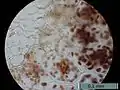 Amiloplasto visto bajo el microscopio