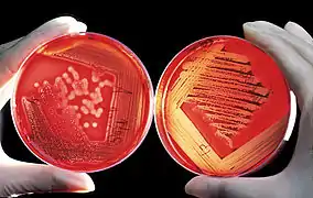 Agar sangre para el diagnóstico de infecciones. A la izquierda positivo para infección por Staphylococcus, a la derecha positivo para un cultivo de Streptococcus