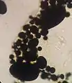 Amiloplastos observados en células de papa (Solanum tuberosum). Lente 40x