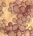 Amiloplastos de células de papa a 10x10 aumentos ópticos.