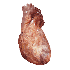 Corazón humano en movimiento. Es visible el inicio de la arteria aorta y de la arteria pulmonar