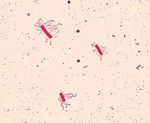 Bacillus cereus (Firmicutes)