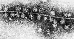 Bacteriófago Qβ (Fiersviridae)