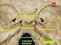 Foramen yugular