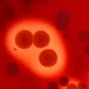 Beta hemolisis en agar sangre, se observan tres colonias centrales y sus halos de hemolisis.