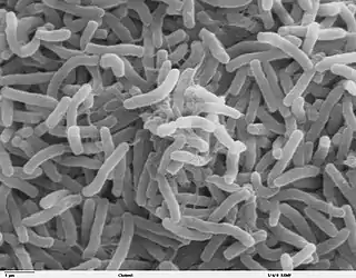 Vibrio cholerae (Proteobacteria)