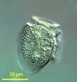 Dinophysis acuminata (Dinoflagellata)