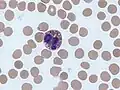 Imagen tomada con un microscopio óptico en la que se observa un eosinófilo rodeado de glóbulos rojos. Tinción de Giemsa.