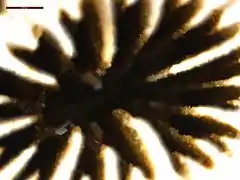 Septos de un coralito