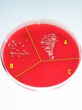 A Petri dish containing a red growth medium, and subdivided into three sectors, labeled A, B and C, respectively. There is much visible microbial growth in culture A, some growth in culture B, and virtually no growth in culture C.