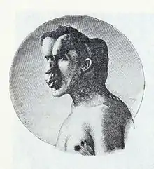 Joseph Merrick 1886.