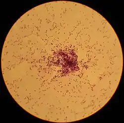 Streptococcus lactis