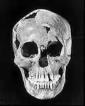 Cráneo de la mujer de Minnesota, encontrado en Pelican Rapids junto al resto del esqueleto. Es uno de los restos humanos más antiguos (~8000 años) de los encontrados en Norteamérica.