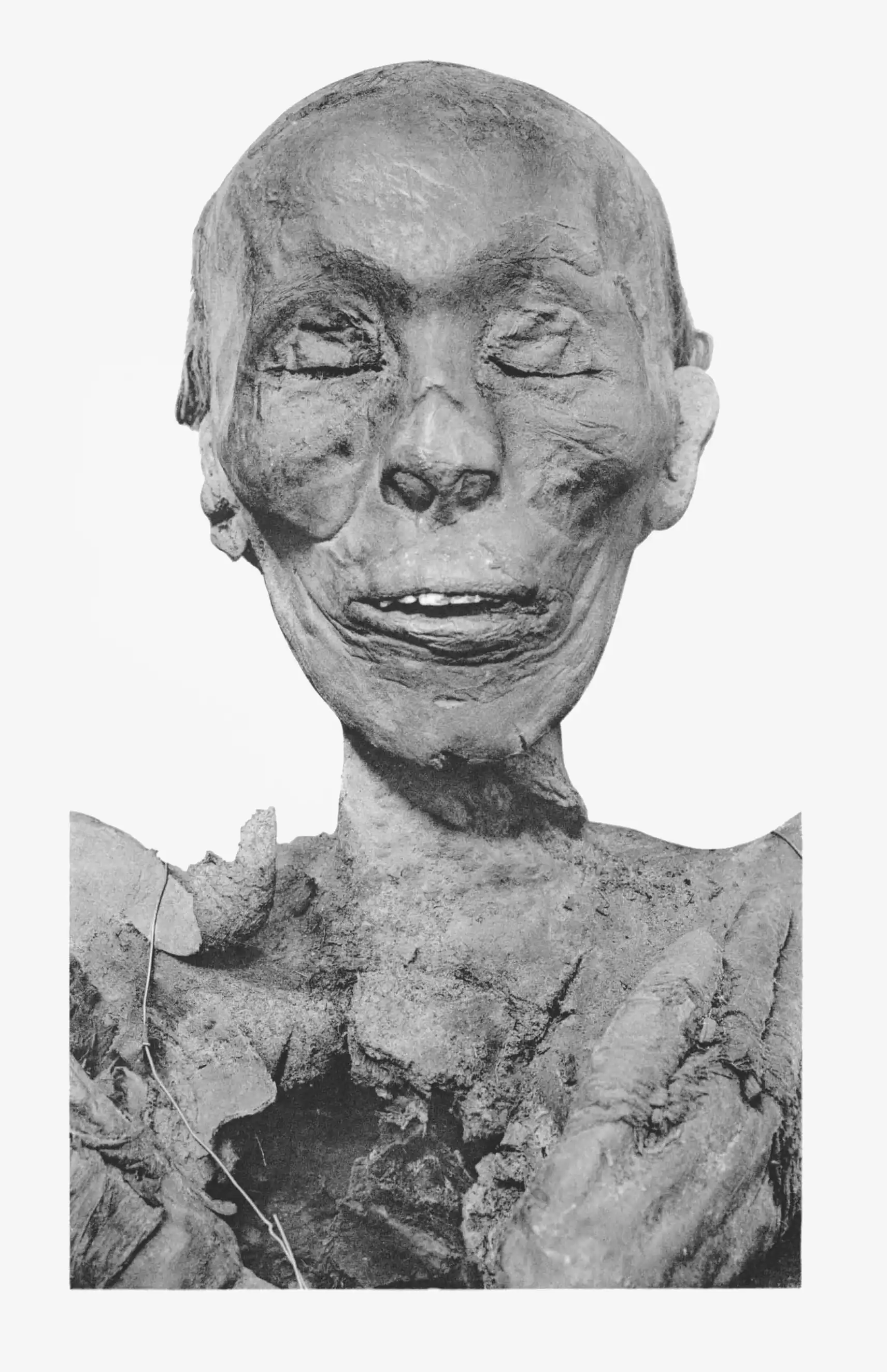 Thutmose_II_mummy_head