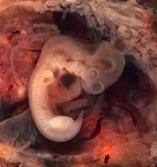 Embrión humano de cinco semanas