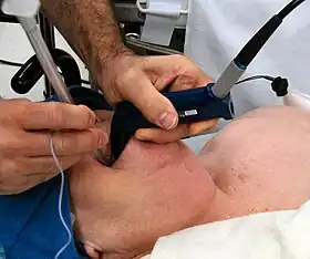 A tube and a camera being inserted into the mouth of a patient