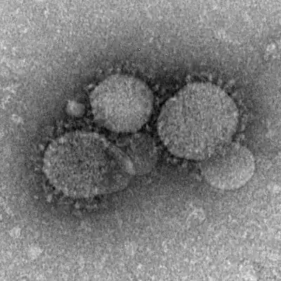 MERS coronaviruses under electron microscope
