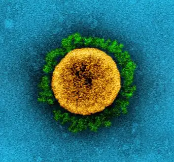 False-colour transmission electron micrograph of a B.1.1.7 variant coronavirus. The variant's increased transmissibility is believed to be due to changes in the structure of the spike proteins, shown here in green.