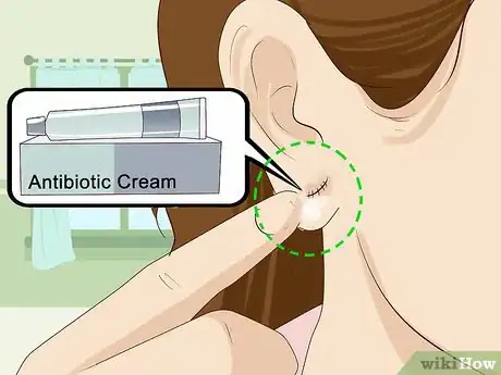Cómo cerrar las dilataciones de la oreja con estos sencillos pasos
