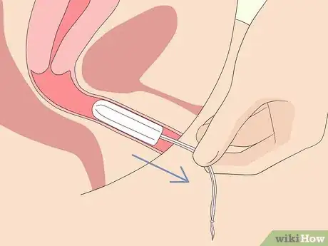 How to Use a Tampon (with Pictures) - wikiHow