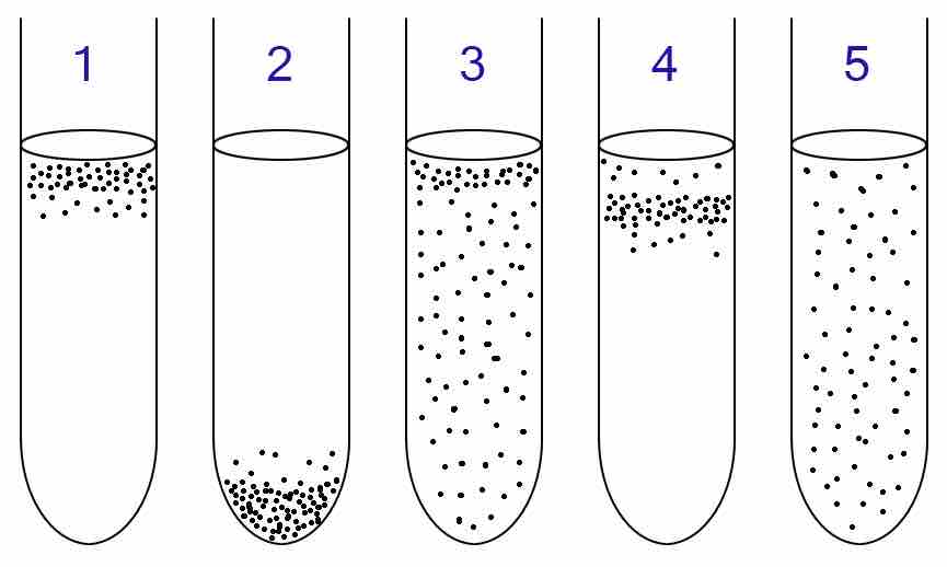 Identity of aerobic and anaerobic bacteria