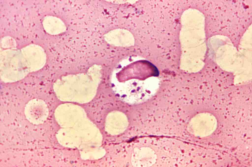 Leishmania donovani