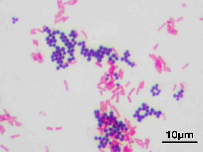 Gram Staining