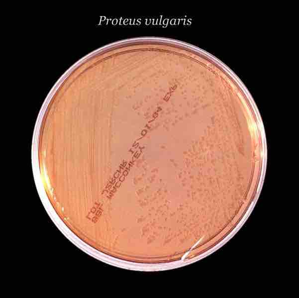 Proteus vulgaris on MacConkey agar