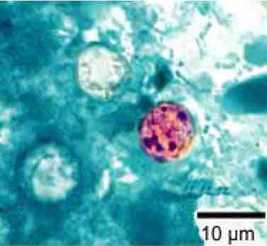 Cyclospora cayetanensis oocysts