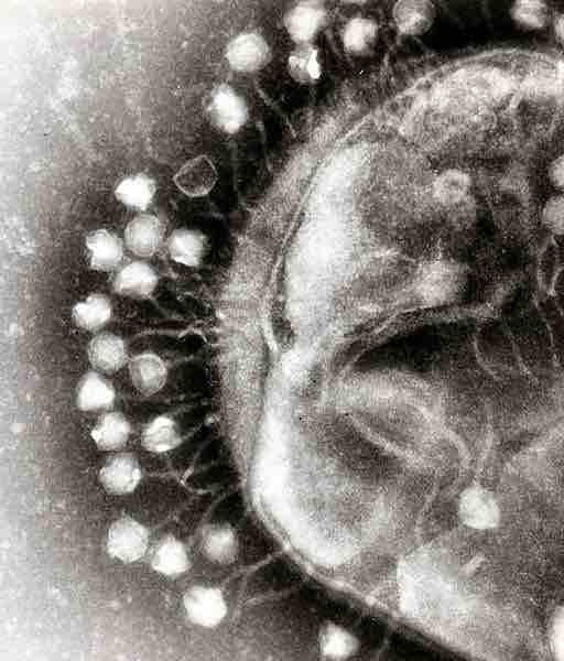 Electron micrograph of Bacteriophages