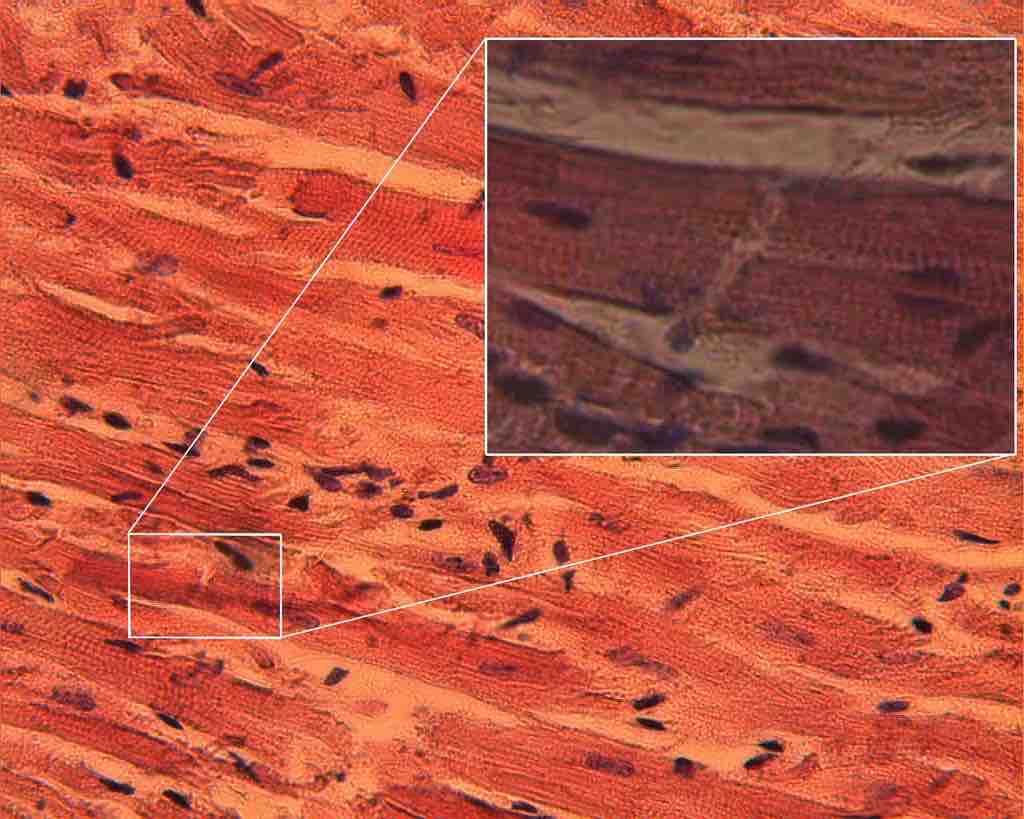 Intercalated disk in heart muscle contains gap junctions