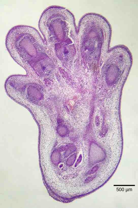 Apoptosis