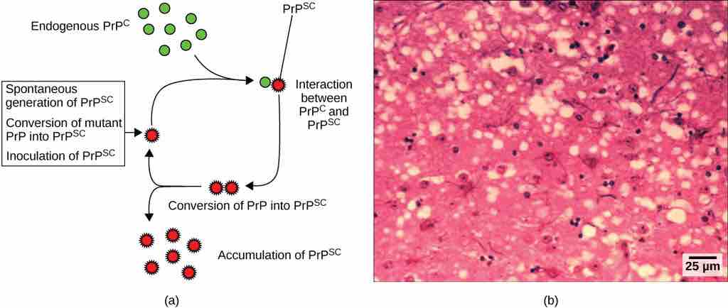 Example of the formation of a prion