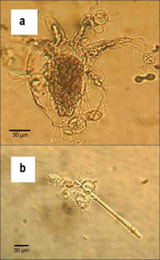 Parasitic chytrids